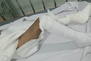 Vết thương trên người bé trai được băng bó