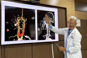 Loại bỏ khối u 70 năm cho nữ bệnh nhân 67 tuổi