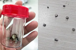 Bé trai 4 tuổi nuốt 10 cục pin và nam châm gây thủng ruột