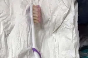 Chiếc bàn chải đánh răng nằm trong thực quản của bệnh nhân được các bác sĩ nội soi lấy ra ngoài. Ảnh: BVĐKĐN