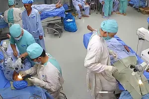 Bác sĩ Bệnh viện Mắt Tây Nam thực hiện các ca mổ đục thủy tinh thể trên bệnh nhân