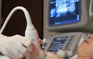 Breast cancer is the most popular cancer amongst female (Photo: SGGP)