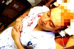 Dr. Le Quang Duong bleeds after the assault (Photo: SGGP)