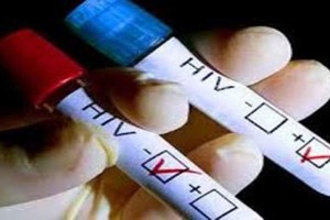 People living with HIV surge in many localities