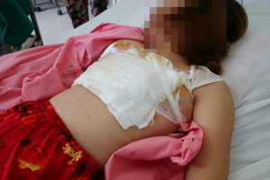 Infirmaries asked to tighten cosmetic surgery services