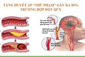 25 percent of Vietnam’s population have heart disease, high blood pressure