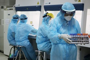 Factors affecting Covid-19 testing kit prices: Ministry’s explanation