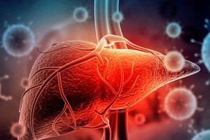 Vietnam not records children with acute hepatitis of unknown origin