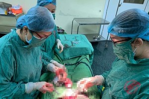 Vietnamese doctors conduct surgery on woman with two wombs carrying twin in each