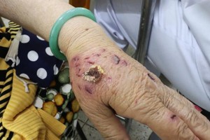 More than 10,000 residents in HCMC required rabies vaccine due to animal bites