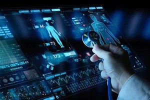 Health station in outlying district adopts AI for X-rays analysis