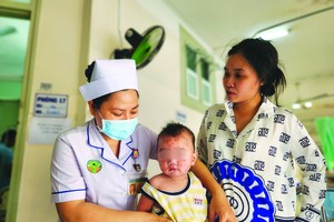 MoH urges to take precautions against measles, influenza, respiratory diseases