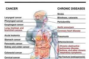 Ministry announces over 100,000 tobacco-related deaths annually in Vietnam