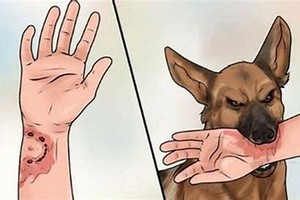 HCMC strengthens rabies preventive measures in humans