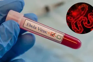 Vietnam strengthens preparedness against Ebola outbreak risks