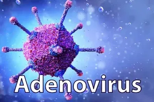MoH issues health alert as adenovirus infections, pink eye cases rise