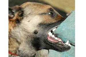 Một bệnh nhân bị suy hô hấp, tụt huyết áp do chó cắn