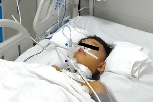 Bệnh nhi đã dần ổn định và sớm xuất viện. Ảnh: BV cung cấp