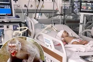 Bệnh nhi tỉnh táo ngay sau mổ, đến nay sức khoẻ ổn định