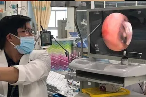 Bác sĩ đang nội soi gắp dị vật