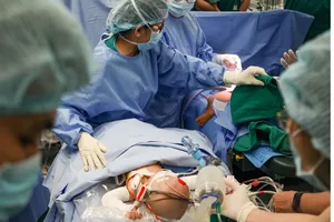 Khoảnh khắc 2 bé được tách rời tại Bệnh viện Nhi đồng Thành phố. Ảnh: HOÀNG HÙNG