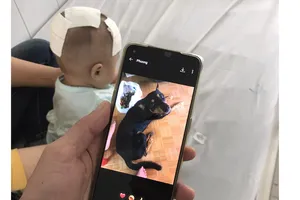 Bé gái sau khi được phẫu thuật