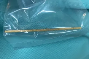 Gắp cây tăm nhọn dài 7cm nằm trong bụng bệnh nhi