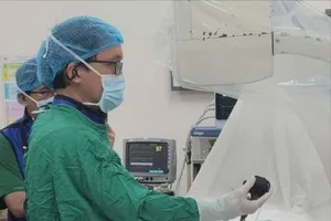 Bác sĩ đang tán sỏi túi mật xuyên gan qua da cho người bệnh