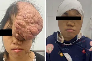 Người bệnh trước và sau phẫu thuật