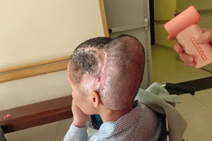 Hiện người bệnh đã xuất viện, sinh hoạt ổn định và dần trở lại cuộc sống bình thường.