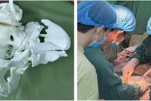 Ứng dụng công nghệ in 3D để tái tạo chính xác cấu trúc khung chậu của người bệnh trước mổ 