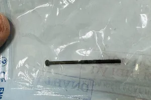 Quảng Ngãi: Bé trai 3 tuổi nuốt đinh vít dài 4cm khi đang chơi đèn pin