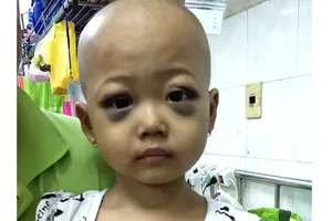 Cháu bé 4 tuổi mắc bệnh hiểm nghèo
