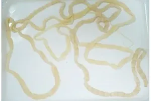 Không quá hoang mang