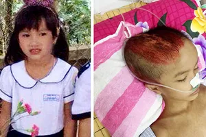 Bé 7 tuổi di chứng nặng sau tai nạn