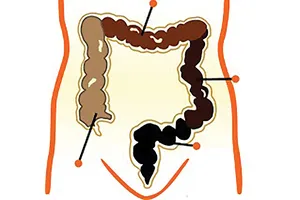 Táo bón, hôi miệng, đầy hơi nhanh chóng biến mất