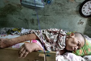 黃蘇蝦亟需再度入院接受治療。