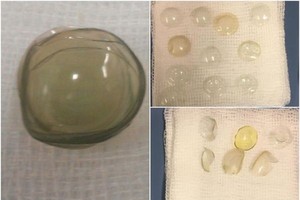 （資料圖源：互聯網）