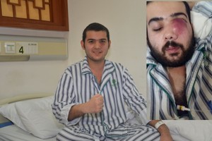 治療前後對比，治療後的TATCHANON明顯變帥了。