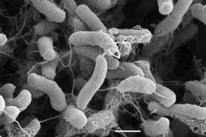 掃瞄電鏡下的霍亂弧菌。（圖片來源：www.rki.de）