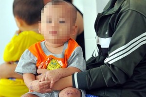 若小兒身上和口腔出現小小的紅疹，請莫掉以輕心，應立即就醫。