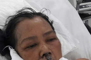 目前她住在阮知方醫院重症急救室3號病床接受醫治。