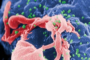 HIV病毒的顯微照相。(圖源：美國疾病管制局)