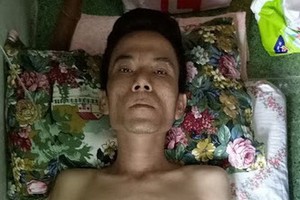 鄧偉發病倒身體消瘦無力。