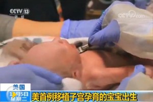 美首例移植子宮內孕育寶寶誕生。（圖源：CCTV視頻截圖）