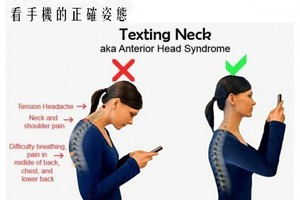 動動脖子預防“手機脖”。（示意圖源：互聯網）