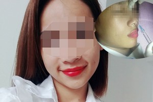 少女注射填充劑隆鼻後，導致單眼失明。（圖源：當事人提供）