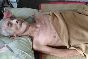 潘錦喜中風後失去自理能力。