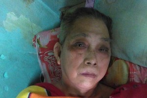 畢洛中風後生活陷入困境。