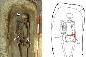 骸骨的一側手臂被截肢，並且斷腕處接上了一把匕首。